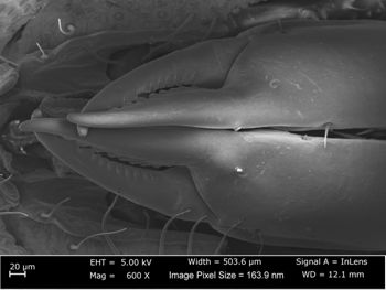 Media type: image;   Invertebrate Zoology 162243 Aspect: female cheliceral teeth